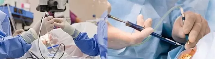 Kirurgija za vraćanje vida